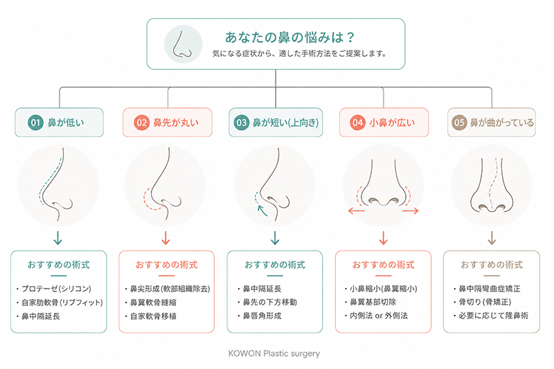 鼻の悩み(低い・丸い・短い・広い・曲がっている)ごとに必要な鼻整形術式を示す選択フローチャート