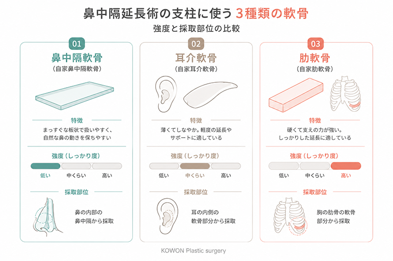 鼻中隔延長術の支柱に使う3種類の軟骨(鼻中隔軟骨・耳介軟骨・肋軟骨)の強度と採取部位の比較図
