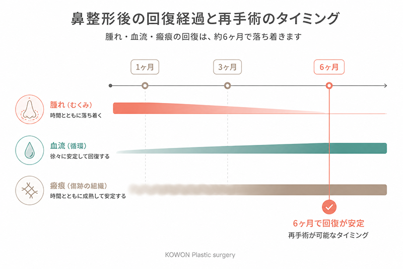 鼻整形後の腫れ・血流・瘢痕の回復経過と、再手術が可能になる6ヶ月のタイミングを示すタイムライン図