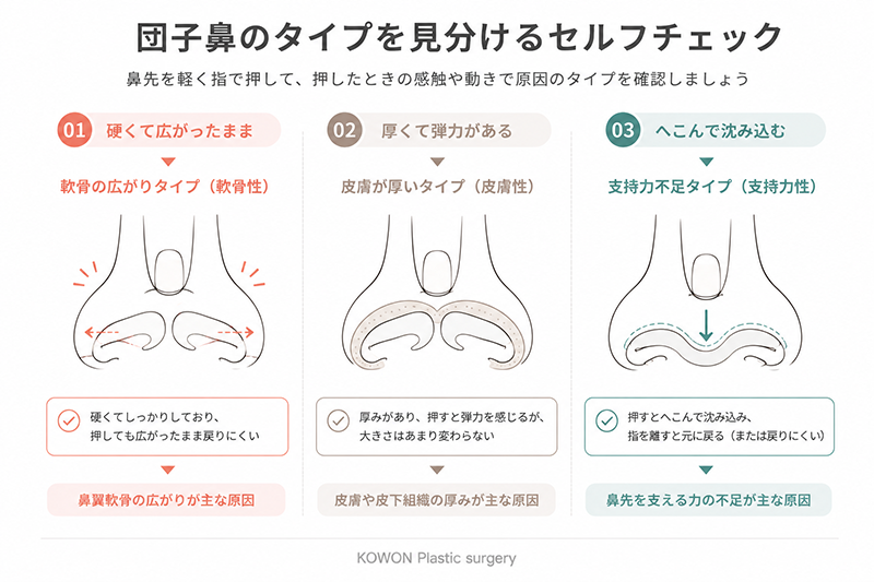 鼻先を指で押して団子鼻のタイプ(硬い=軟骨性・厚い=皮膚性・沈む=支持力不足)を見分けるセルフチェック図
