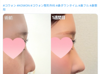 화면 캡처 2026-07-16 172311.png