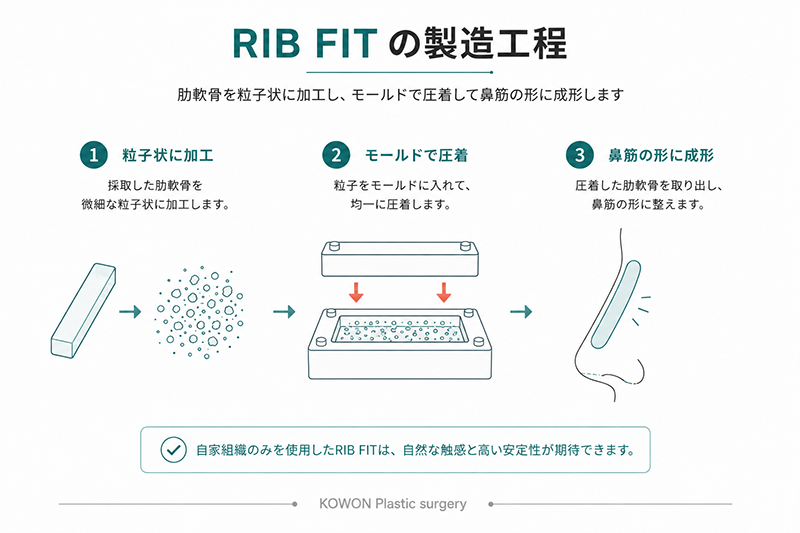 採取した肋軟骨を微細な粒子状に加工し、モールドで圧着して鼻筋の形に成形するRIB FITの工程図