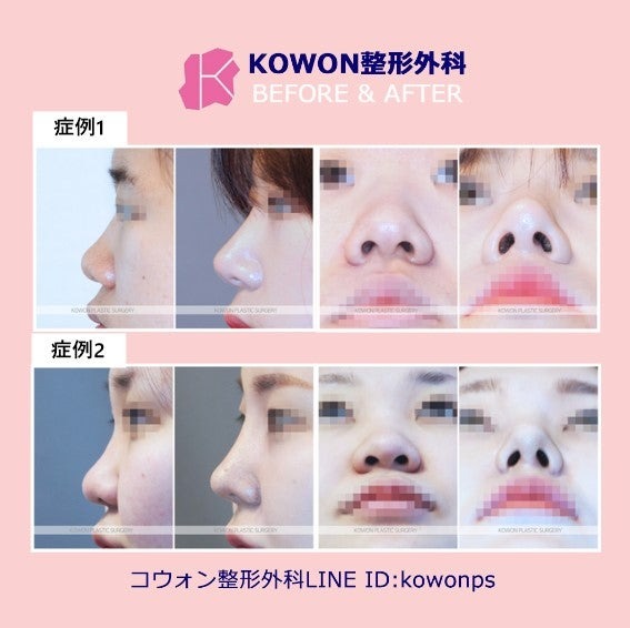 o0567056615068493628.jpg